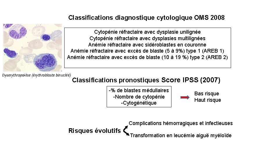 Classifications diagnostique cytologique OMS 2008 Cytopénie réfractaire avec dysplasie unilignée Cytopénie réfractaire avec dysplasies