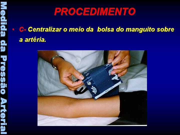 PROCEDIMENTO • C- Centralizar o meio da bolsa do manguito sobre a artéria. 