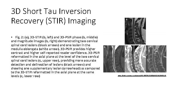 3 D Short Tau Inversion Recovery (STIR) Imaging • Fig. 2: (a), 3 D-STIR