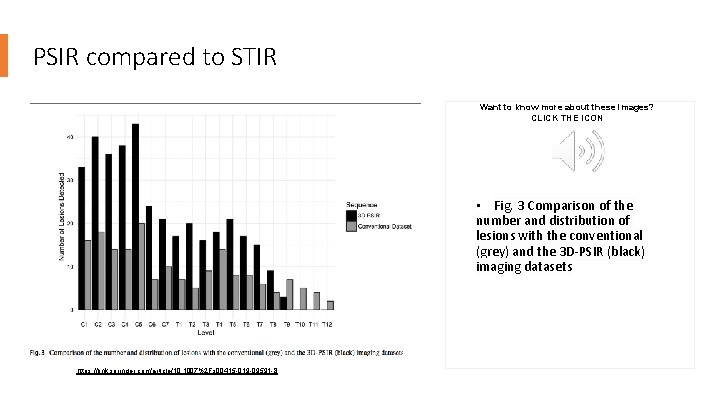 PSIR compared to STIR Want to know more about these images? CLICK THE ICON