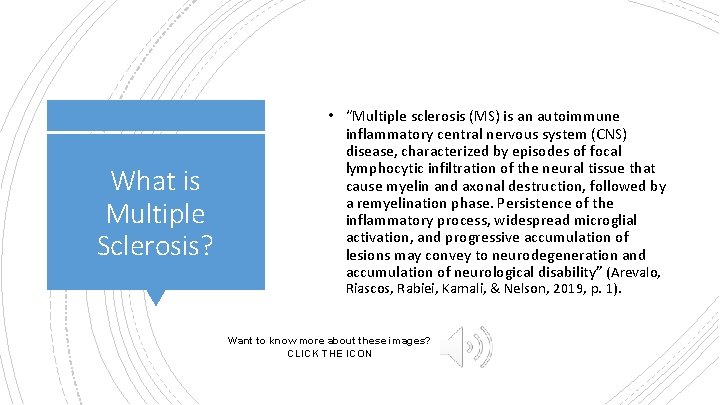  • “Multiple sclerosis (MS) is an autoimmune What is Multiple Sclerosis? inflammatory central