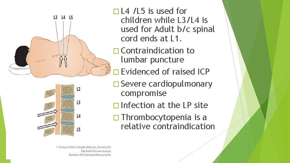 � L 4 /L 5 is used for children while L 3/L 4 is