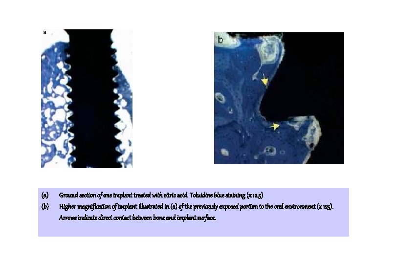 (a) (b) Ground section of one implant treated with citric acid. Toluidine blue staining (a) (b) Ground section of one implant treated with citric acid. Toluidine blue staining