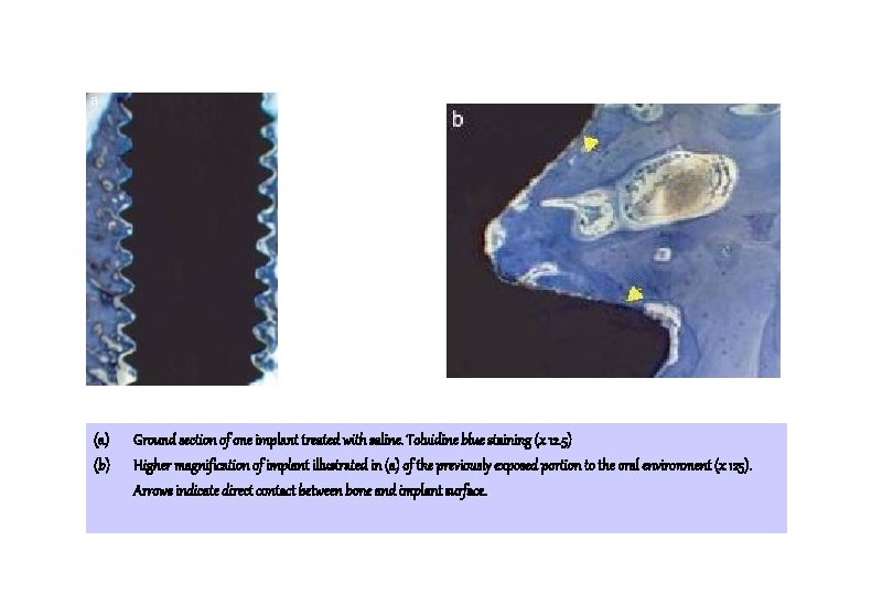 (a) (b) Ground section of one implant treated with saline. Toluidine blue staining (x (a) (b) Ground section of one implant treated with saline. Toluidine blue staining (x