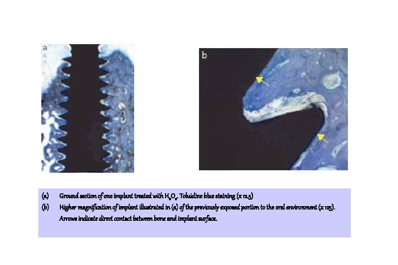 (a) (b) Ground section of one implant treated with H 2 O 2. Toluidine (a) (b) Ground section of one implant treated with H 2 O 2. Toluidine
