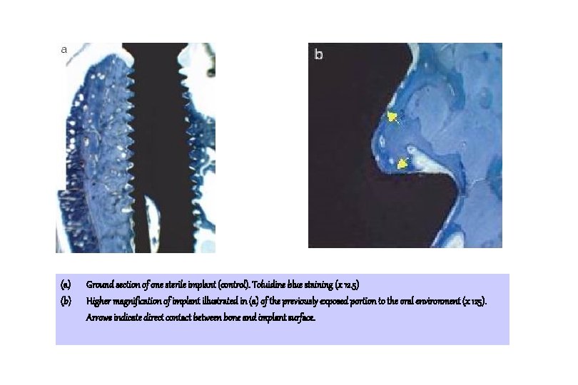 (a) (b) Ground section of one sterile implant (control). Toluidine blue staining (x 12. (a) (b) Ground section of one sterile implant (control). Toluidine blue staining (x 12.