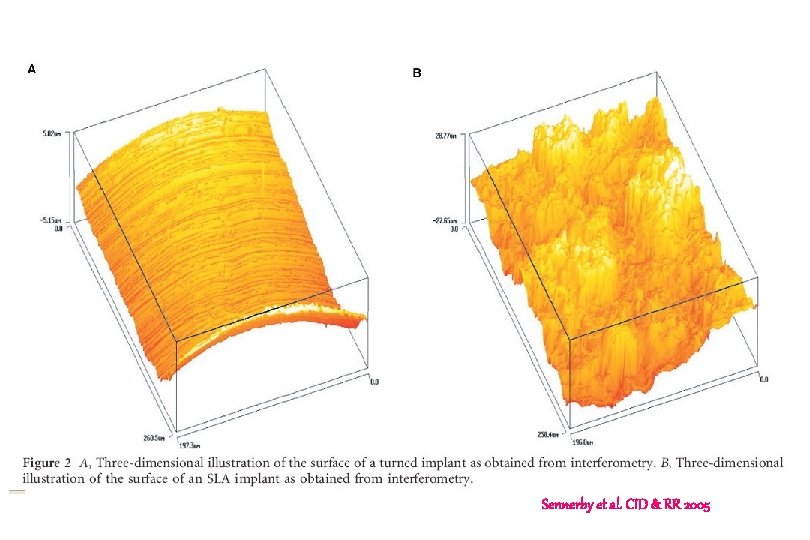 Sennerby et al. CID & RR 2005 Sennerby et al. CID & RR 2005