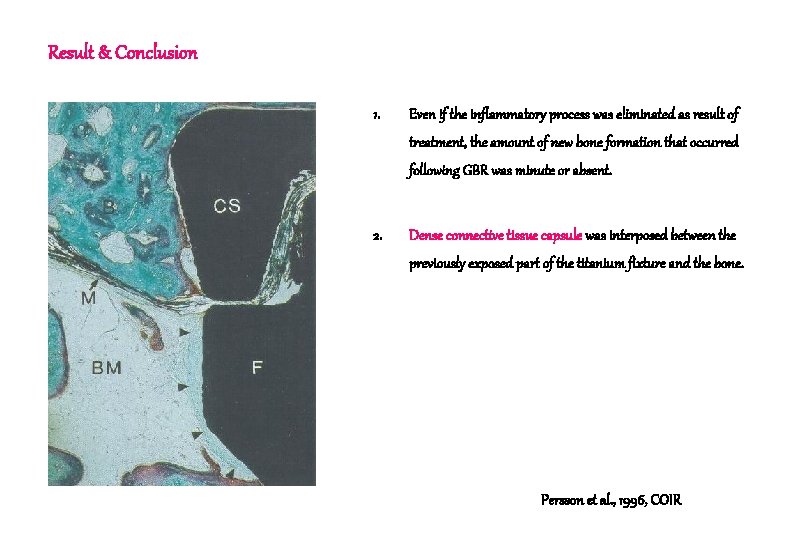 Result & Conclusion 1. Even if the inflammatory process was eliminated as result of Result & Conclusion 1. Even if the inflammatory process was eliminated as result of