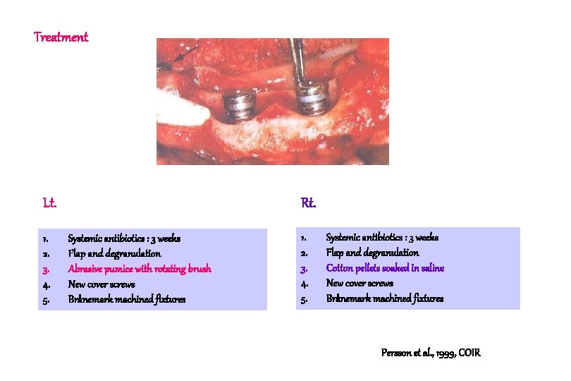 Treatment Lt. 1. 2. 3. 4. 5. Rt. Systemic antibiotics : 3 weeks Flap Treatment Lt. 1. 2. 3. 4. 5. Rt. Systemic antibiotics : 3 weeks Flap