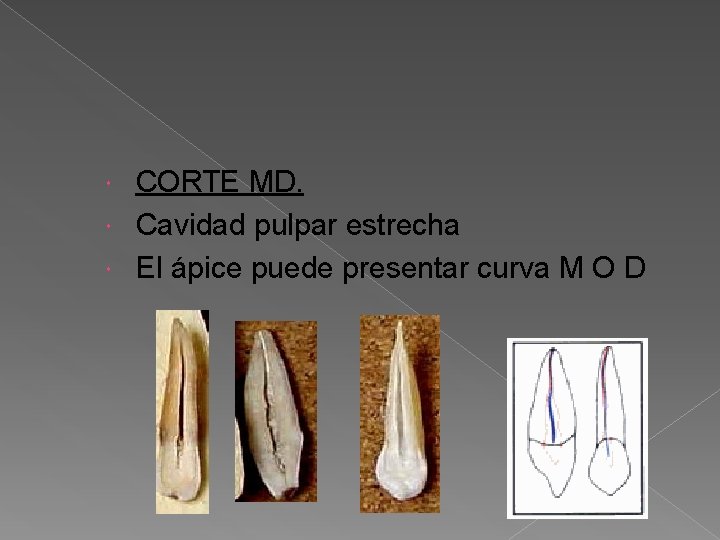 CORTE MD. Cavidad pulpar estrecha El ápice puede presentar curva M O D CORTE MD. Cavidad pulpar estrecha El ápice puede presentar curva M O D