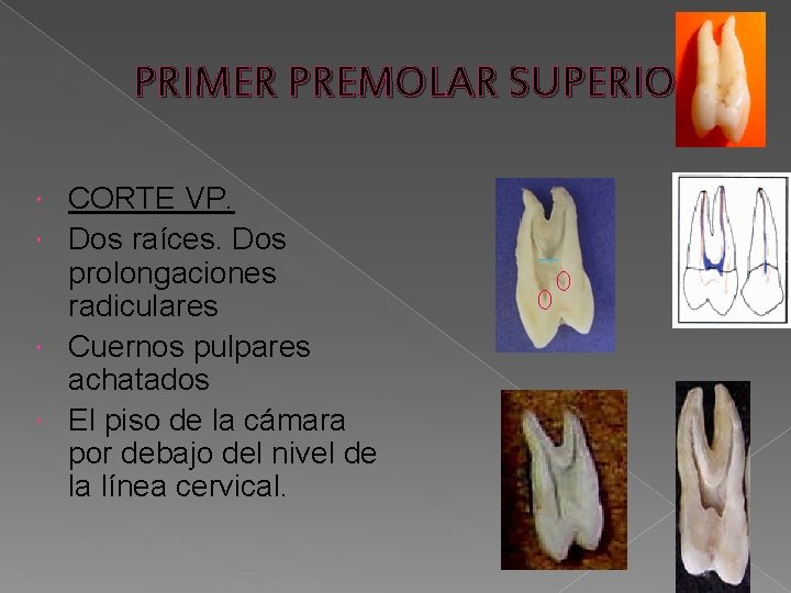 PRIMER PREMOLAR SUPERIOR CORTE VP. Dos raíces. Dos prolongaciones radiculares Cuernos pulpares achatados El PRIMER PREMOLAR SUPERIOR CORTE VP. Dos raíces. Dos prolongaciones radiculares Cuernos pulpares achatados El