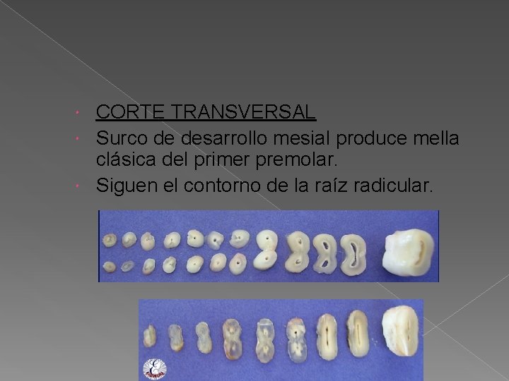 CORTE TRANSVERSAL Surco de desarrollo mesial produce mella clásica del primer premolar. Siguen el CORTE TRANSVERSAL Surco de desarrollo mesial produce mella clásica del primer premolar. Siguen el