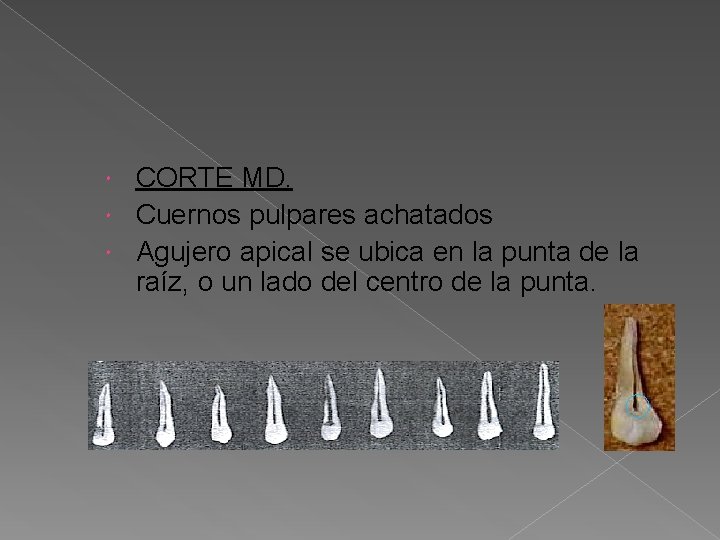 CORTE MD. Cuernos pulpares achatados Agujero apical se ubica en la punta de la CORTE MD. Cuernos pulpares achatados Agujero apical se ubica en la punta de la