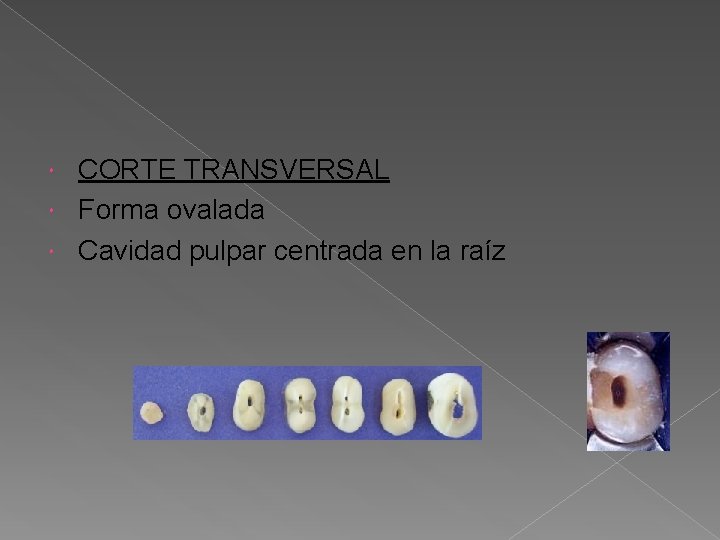 CORTE TRANSVERSAL Forma ovalada Cavidad pulpar centrada en la raíz CORTE TRANSVERSAL Forma ovalada Cavidad pulpar centrada en la raíz