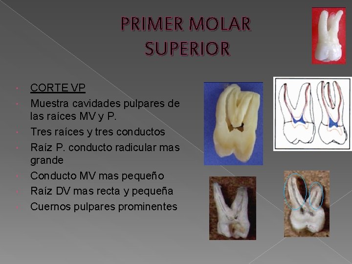 PRIMER MOLAR SUPERIOR CORTE VP Muestra cavidades pulpares de las raíces MV y P. PRIMER MOLAR SUPERIOR CORTE VP Muestra cavidades pulpares de las raíces MV y P.