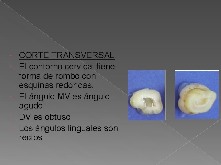 CORTE TRANSVERSAL El contorno cervical tiene forma de rombo con esquinas redondas. El CORTE TRANSVERSAL El contorno cervical tiene forma de rombo con esquinas redondas. El