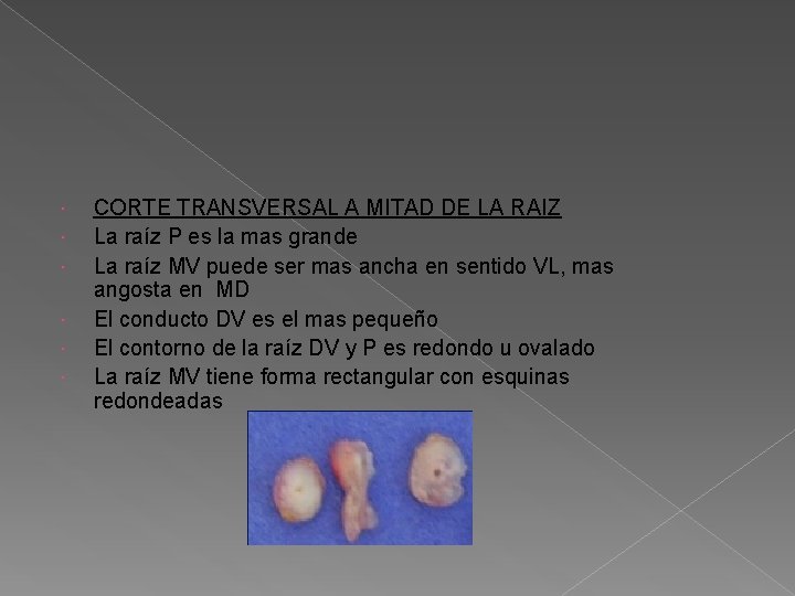 CORTE TRANSVERSAL A MITAD DE LA RAIZ La raíz P es la mas CORTE TRANSVERSAL A MITAD DE LA RAIZ La raíz P es la mas