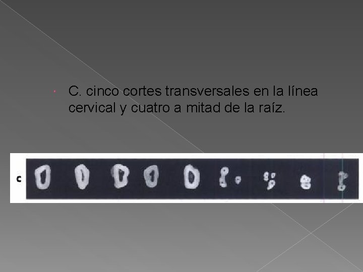 C. cinco cortes transversales en la línea cervical y cuatro a mitad de C. cinco cortes transversales en la línea cervical y cuatro a mitad de