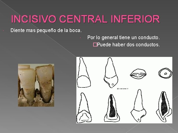 INCISIVO CENTRAL INFERIOR Diente mas pequeño de la boca. Por lo general tiene un INCISIVO CENTRAL INFERIOR Diente mas pequeño de la boca. Por lo general tiene un