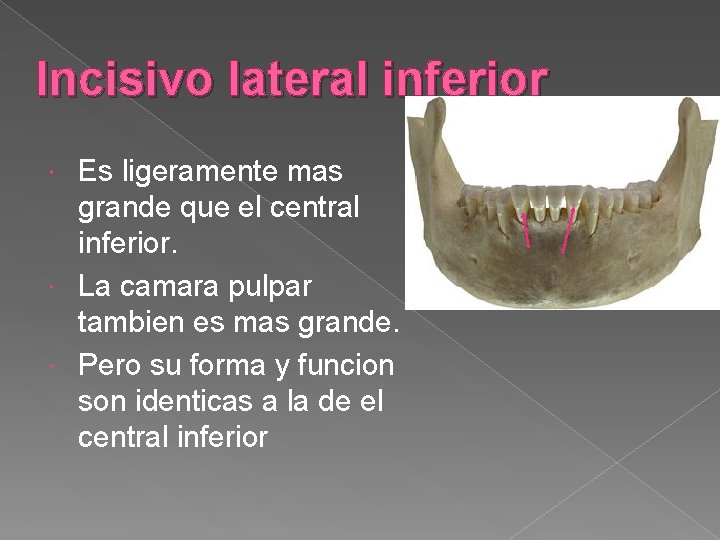 Incisivo lateral inferior Es ligeramente mas grande que el central inferior. La camara pulpar Incisivo lateral inferior Es ligeramente mas grande que el central inferior. La camara pulpar