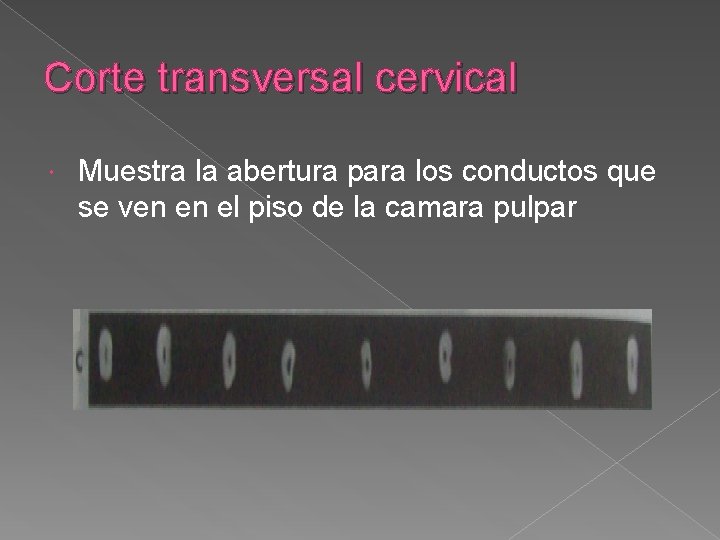 Corte transversal cervical Muestra la abertura para los conductos que se ven en el Corte transversal cervical Muestra la abertura para los conductos que se ven en el