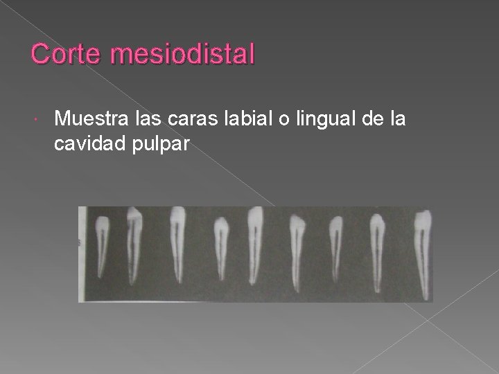 Corte mesiodistal Muestra las caras labial o lingual de la cavidad pulpar Corte mesiodistal Muestra las caras labial o lingual de la cavidad pulpar