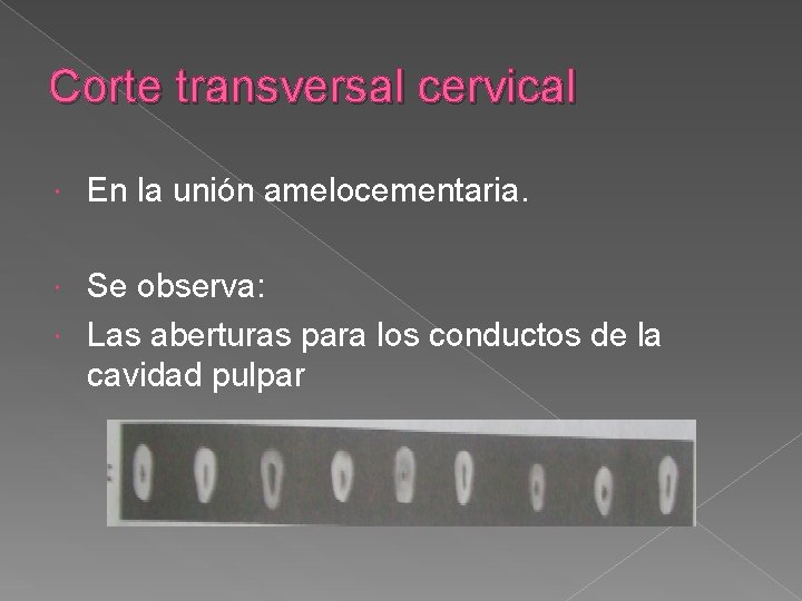 Corte transversal cervical En la unión amelocementaria. Se observa: Las aberturas para los conductos Corte transversal cervical En la unión amelocementaria. Se observa: Las aberturas para los conductos