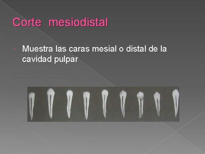 Corte mesiodistal Muestra las caras mesial o distal de la cavidad pulpar Corte mesiodistal Muestra las caras mesial o distal de la cavidad pulpar