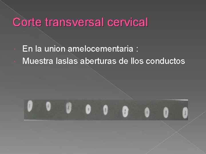 Corte transversal cervical En la union amelocementaria : Muestra laslas aberturas de llos conductos Corte transversal cervical En la union amelocementaria : Muestra laslas aberturas de llos conductos