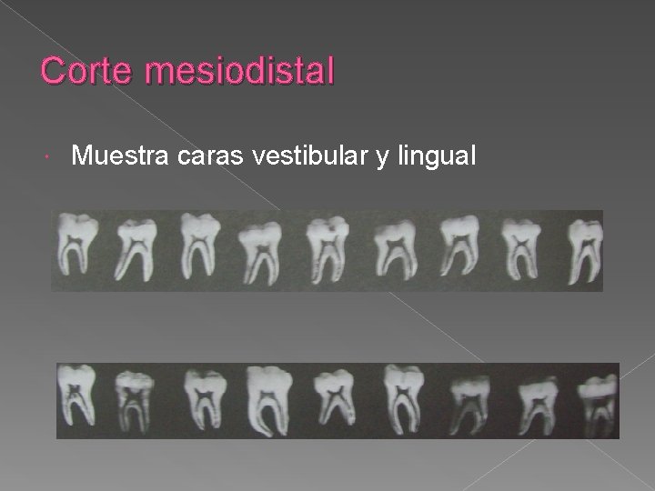 Corte mesiodistal Muestra caras vestibular y lingual Corte mesiodistal Muestra caras vestibular y lingual