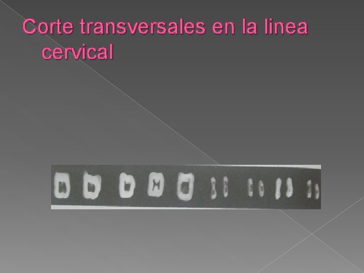 Corte transversales en la linea cervical Corte transversales en la linea cervical