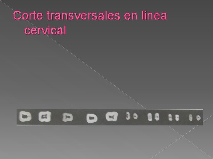 Corte transversales en linea cervical Corte transversales en linea cervical