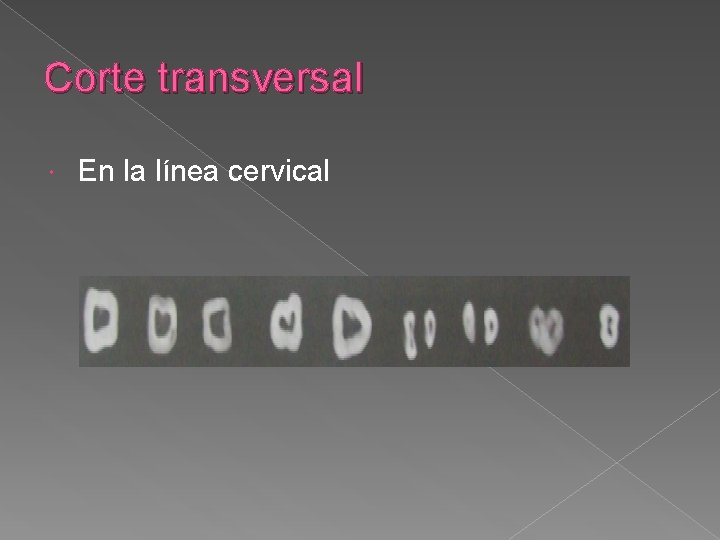 Corte transversal En la línea cervical Corte transversal En la línea cervical