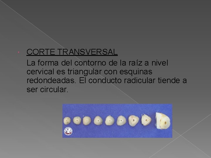 CORTE TRANSVERSAL La forma del contorno de la raíz a nivel cervical es CORTE TRANSVERSAL La forma del contorno de la raíz a nivel cervical es