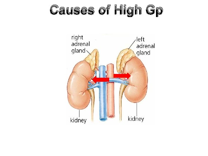 Causes of High Gp 