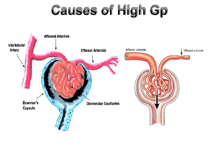 Causes of High Gp 