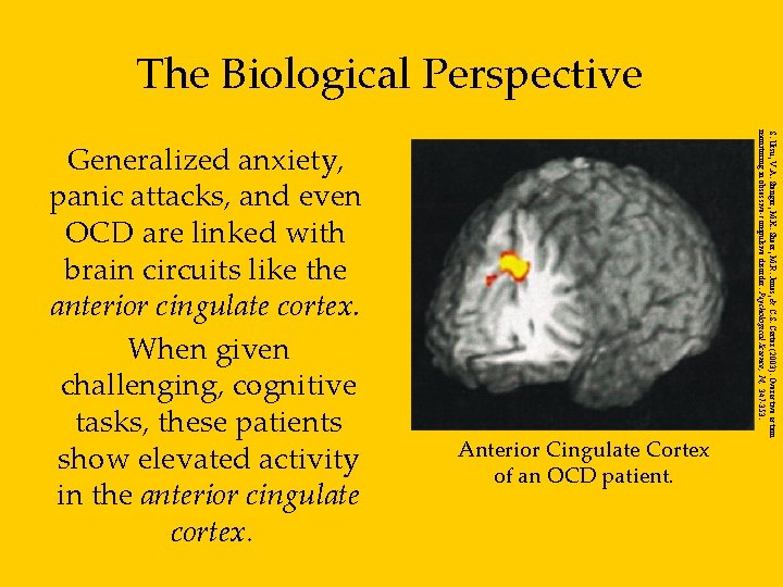 The Biological Perspective Anterior Cingulate Cortex of an OCD patient. S. Ursu, V. A.