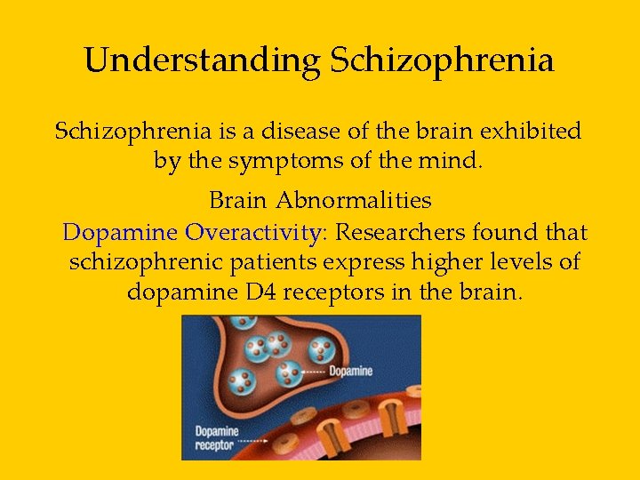 Understanding Schizophrenia is a disease of the brain exhibited by the symptoms of the