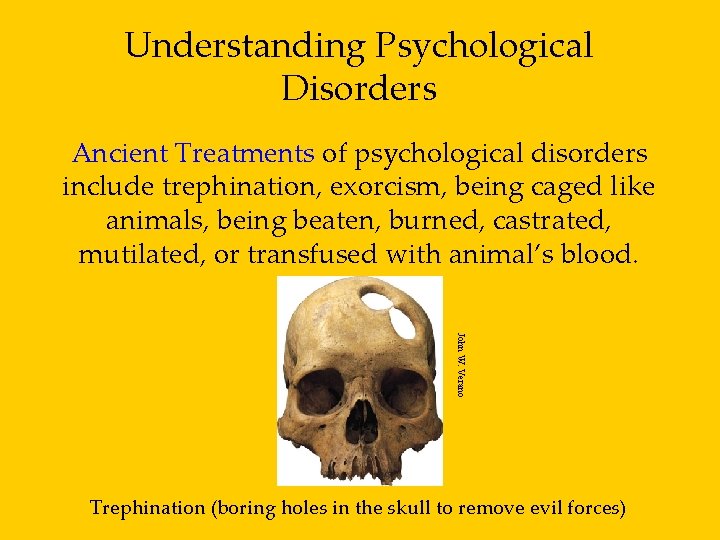 Understanding Psychological Disorders Ancient Treatments of psychological disorders include trephination, exorcism, being caged like