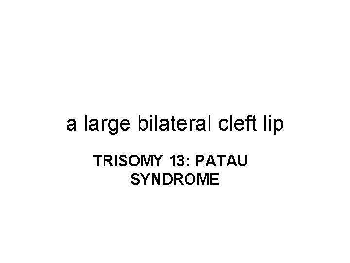 a large bilateral cleft lip TRISOMY 13: PATAU SYNDROME 