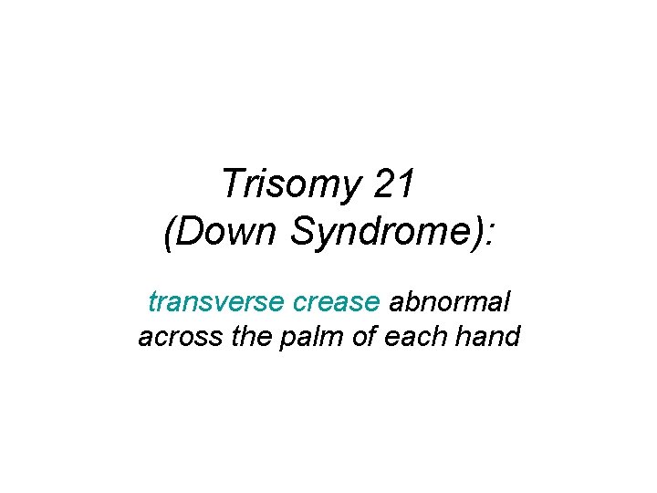 Trisomy 21 (Down Syndrome): transverse crease abnormal across the palm of each hand 