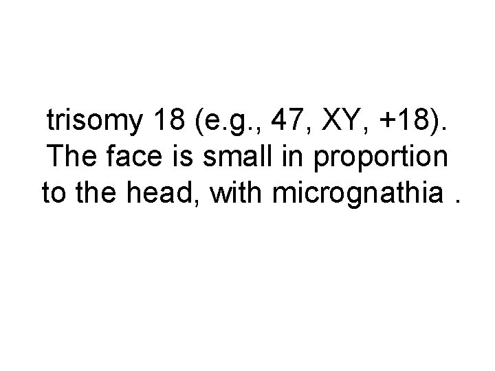 trisomy 18 (e. g. , 47, XY, +18). The face is small in proportion