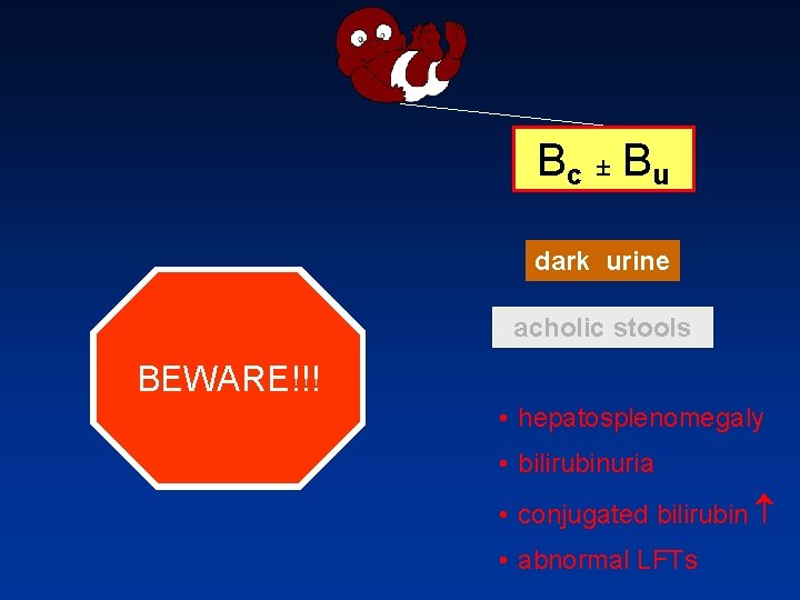 Bc ± Bu dark urine acholic stools BEWARE!!! • hepatosplenomegaly • bilirubinuria • conjugated
