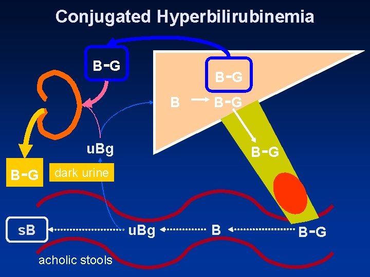 Conjugated Hyperbilirubinemia B -G B- B -G u. Bg B -G dark urine s.