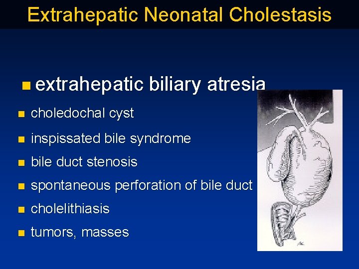 Extrahepatic Neonatal Cholestasis n extrahepatic biliary atresia n choledochal cyst n inspissated bile syndrome