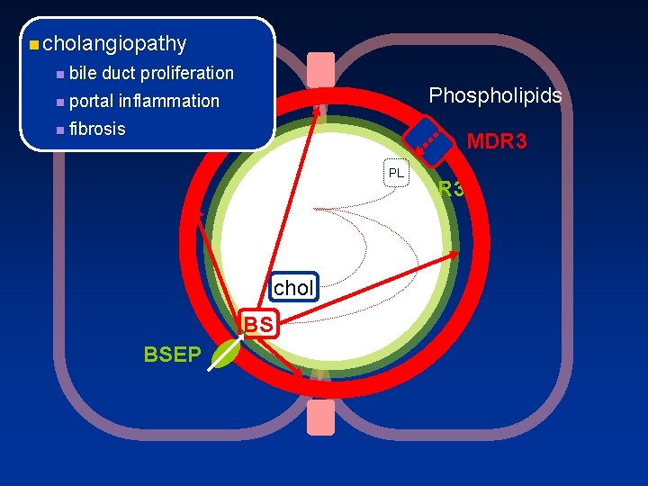 n cholangiopathy n bile duct proliferation n portal Phospholipids inflammation n fibrosis MDR 3