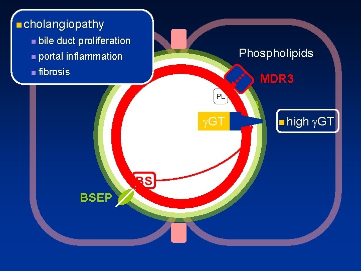 n cholangiopathy n bile duct proliferation n portal Phospholipids inflammation n fibrosis MDR 3