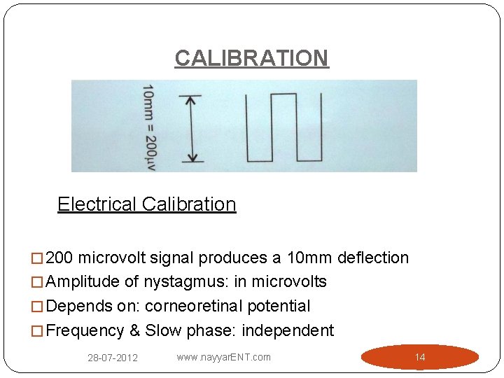 CALIBRATION Electrical Calibration � 200 microvolt signal produces a 10 mm deflection � Amplitude