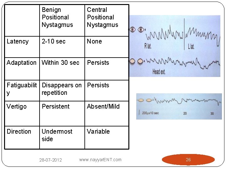 Latency Benign Positional Nystagmus Central Positional Nystagmus 2 -10 sec None Adaptation Within 30