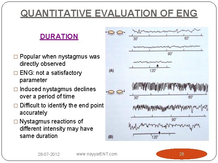 QUANTITATIVE EVALUATION OF ENG DURATION � Popular when nystagmus was directly observed � ENG: